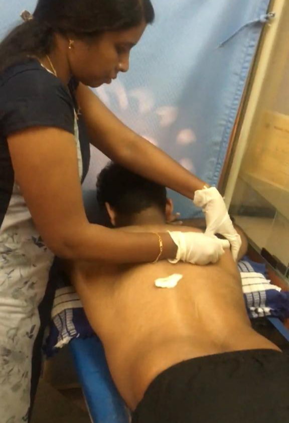 Dry Needling and Physical Therapy Treatment in Bangalore
