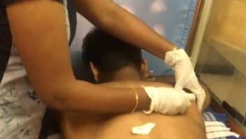 Dry Needling Therapy,physiotherapy clinics in pai layout